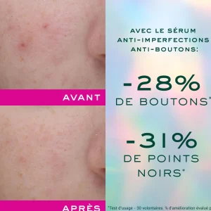 NUXE Sérum anti-imperfections anti-boutons | Zinc [pca] | Teint Unifié & Pores Resserreés